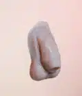 Packer Penile Prosthesis at Rest ( bwya)